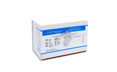 Онкомаркеры  Онко ИФА СА 19-9