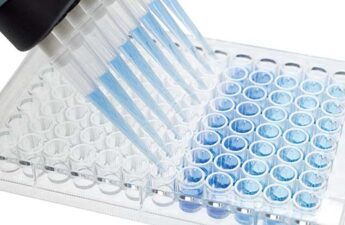 ИФА ДИАГНОСТИКА