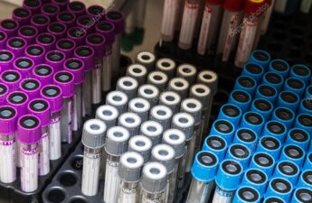 РАСХОДНЫЕ МАТЕРИАЛЫ